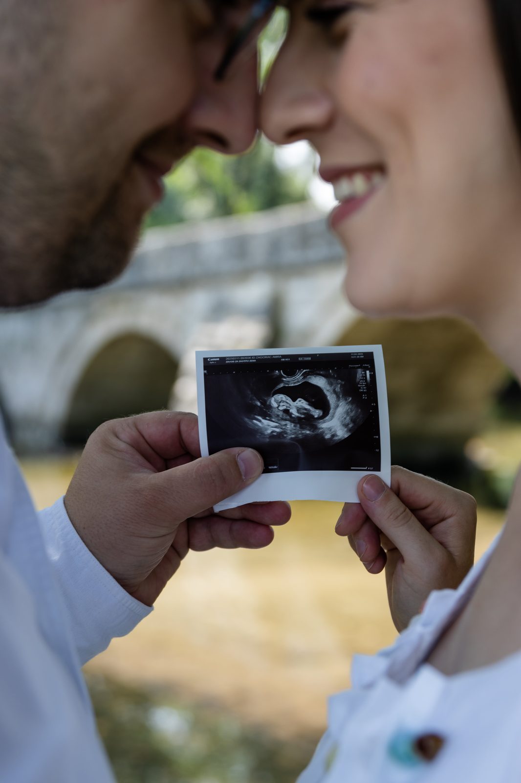 Trudnoća – Amra & Aldin